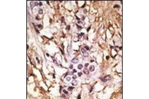 Immunohistochemistry (Paraffin-embedded Sections) (IHC (p)) image for anti-Microtubule-Associated Protein 1 Light Chain 3 alpha (MAP1LC3A) (AA 77-106), (C-Term) antibody (ABIN388474)