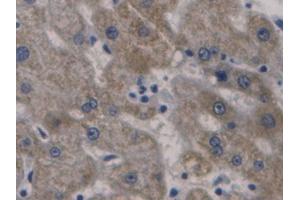 Used in DAB staining on fromalin fixed paraffin-embedded Liver tissue (Hepcidin 抗体  (AA 25-84))