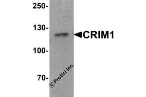 Western Blotting (WB) image for anti-Cysteine Rich Transmembrane BMP Regulator 1 (Chordin-Like) (CRIM1) (C-Term) antibody (ABIN1030343) (CRIM1 抗体  (C-Term))