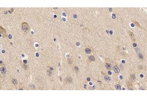 Detection of TNFa in Porcine Cerebrum Tissue using Polyclonal Antibody to Tumor Necrosis Factor Alpha (TNFa) (TNF alpha 抗体  (AA 79-234))