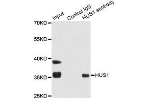 Immunoprecipitation analysis of 200ug extracts of 293T cells using 1ug HUS1 antibody (ABIN1876595). (HUS1 抗体)