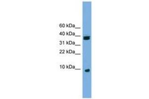 Image no. 1 for anti-Ribosomal Protein S21 (RPS21) (C-Term) antibody (ABIN6745111) (RPS21 抗体  (C-Term))
