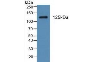 Detection of PDGFRa in Rat Testis Tissue using Polyclonal Antibody to Platelet Derived Growth Factor Receptor Alpha (PDGFRa) (PDGFRA 抗体  (AA 170-387))