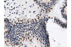 Immunohistochemical staining of paraffin-embedded Human Kidney tissue using anti-QPRT mouse monoclonal antibody. (QPRT 抗体)