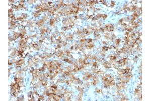 Immunohistochemistry (IHC) image for anti-Steroidogenic Acute Regulatory Protein (STAR) (AA 39-108) antibody (ABIN6940667)