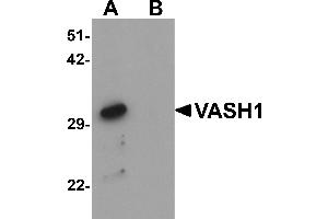 Western blot analysis of VASH1 in human brain tissue lysate with VASH1 antibody at 1 µg/mL in (A) the absence and (B) the presence of blocking peptide. (VASH1 抗体  (C-Term))