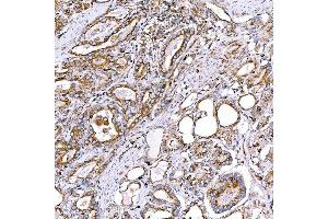 IHC analysis of RAB7/RAB7A using anti-RAB7/RAB7A antibody (ABIN7600597). (RAB7A 抗体  (AA 21-177))