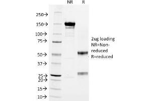 SDS-PAGE Analysis CD3e Mouse Monoclonal Antibody (RIV9).