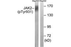 Western blot analysis of extracts from HepG2 cells treated with Na3VO4 0. (JAK2 抗体  (pTyr931))