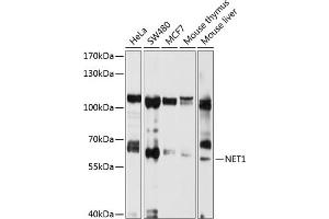 Western blot analysis of extracts of various cell lines, using NET1 antibody (ABIN3021741, ABIN3021742, ABIN1513253 and ABIN6215710) at 1:1000 dilution. (NET1 抗体  (AA 1-300))