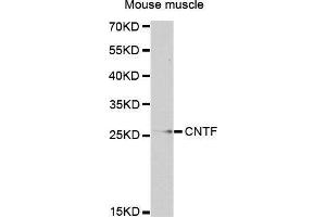 Western Blotting (WB) image for anti-Ciliary Neurotrophic Factor (CNTF) (AA 1-200) antibody (ABIN3015705) (CNTF 抗体  (AA 1-200))