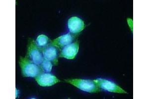 ICC/IF analysis of PSMA in LNCaP cells line, stained with DAPI (Blue) for nucleus staining and monoclonal anti-human PSMA antibody (1:100) with goat anti-mouse IgG-Alexa fluor 488 conjugate (Green). (PSMA 抗体  (AA 117-351))