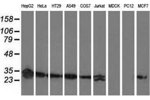 Western blot analysis of extracts (35 µg) from 9 different cell lines by using anti-SPR monoclonal antibody. (SPR 抗体)