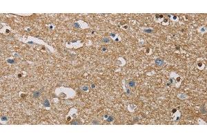 Immunohistochemistry (Paraffin-embedded Sections) (IHC (p)) image for anti-Phosphatidylinositol-5-Phosphate 4-Kinase, Type II, alpha (PIP4K2A) antibody (ABIN7236224)