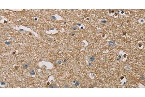 Immunohistochemistry of paraffin-embedded Human brain using PIP4K2A Polyclonal Antibody at dilution of 1:40 (PIP4K2A 抗体)