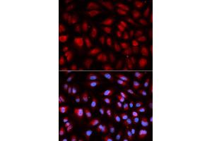 Immunofluorescence analysis of U2OS cell using PLK1 antibody. (PLK1 抗体  (AA 304-603))