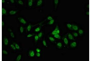 Immunofluorescent analysis of Hela cells using ABIN7172055 at dilution of 1:100 and Alexa Fluor 488-congugated AffiniPure Goat Anti-Rabbit IgG(H+L) (THO Complex 4 抗体  (AA 186-240))