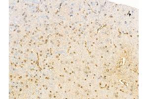 ABIN6255261 and ABIN6267114 at 1/100 staining Rat brain tissue by IHC-P. (EEF2K 抗体  (pSer366))