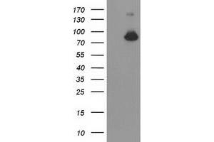 Western Blotting (WB) image for anti-Acyl-CoA Synthetase Short-Chain Family Member 2 (ACSS2) antibody (ABIN1496429) (ACSS2 抗体)