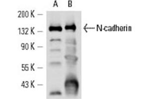 Image no. 1 for anti-Cadherin 2 (CDH2) antibody (ABIN272296) (N-Cadherin 抗体)