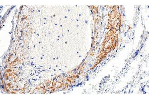 Immunohistochemistry (IHC) image for anti-Actin, alpha 2, Smooth Muscle, Aorta (ACTA2) (N-Term) antibody (ABIN185271)
