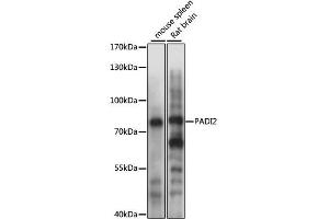Western blot analysis of extracts of various cell lines, using PADI2 antibody (ABIN4904665) at 1:1000 dilution. (PADI2 抗体)