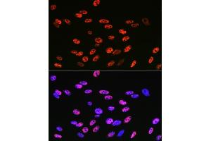 Immunofluorescence (IF) image for anti-Kruppel-Like Factor 4 (Gut) (KLF4) antibody (ABIN7268157)