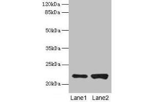 Western blot All lanes: CDC42 antibody at 6 μg/mL Lane 1: Hela whole cell lysate Lane 2: Jurkat whole cell lysate Secondary Goat polyclonal to rabbit IgG at 1/10000 dilution Predicted band size: 22 kDa Observed band size: 22 kDa (CDC42 抗体  (AA 2-188))