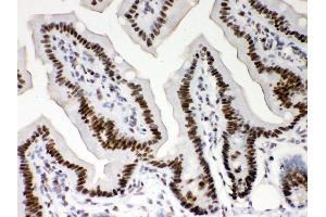 Anti- Nucleophosmin Picoband antibody,IHC(P) IHC(P): Mouse Intestine Tissue (NPM1 抗体  (AA 1-294))