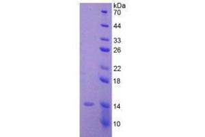 SDS-PAGE analysis of Human AMH Protein. (AMH 蛋白)
