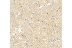 IHC analysis of UBE3A using anti-UBE3A antibody (ABIN7599562).