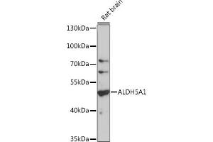 Western blot analysis of extracts of rat brain, using  antibody (6074) at 1:1000 dilution. (ALDH5A1 抗体  (AA 400-500))