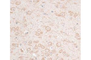 Immunohistochemistry of paraffin-embedded Mouse brain using HMGA1 Polyclonal Antibody at dilution of 1:100 (40x lens). (HMGA1 抗体)