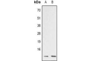 Western blot analysis of ATP5I expression in RT4 (A), COLO205 (B) whole cell lysates.