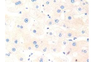 Immunohistochemistry (IHC) image for anti-Cathepsin K (CTSK) (AA 54-317) antibody (ABIN7441856)