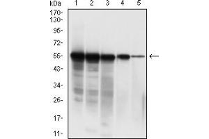 Western blot analysis using SARS-CoV-2-NP3 mAb against human SARS-CoV-2-N (AA: 1-419) recombinant protein. (SARS-CoV-2-NP3 (AA 240-419) 抗体)