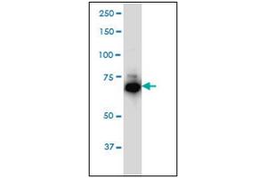 Western Blotting (WB) image for anti-Interleukin-1 Receptor-Associated Kinase 1 (IRAK1) (AA 530-693) antibody (ABIN614625) (IRAK1 抗体  (AA 530-693))