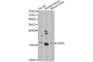 Western blot analysis of extracts of various cell lines, using SNX3 antibody (ABIN6290935) at 1:1000 dilution. (Sorting Nexin 3 抗体)