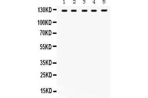 Anti- TRPM8 Picoband antibody, Western blottingAll lanes: Anti TRPM8  at 0. (TRPM8 抗体  (C-Term))