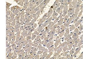 anti-Gametogenetin (GGN) antibody