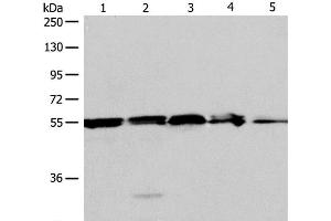 Western Blot analysis of A375, 293T cell and Mouse liver tissue, Jurkat cell and Human fetal kidney tissue using NAMPT Polyclonal Antibody at dilution of 1:700 (NAMPT 抗体)