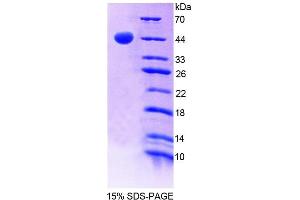 SDS-PAGE analysis of Human GHRHR Protein. (GHRHR 蛋白)