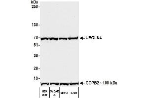 Western Blotting (WB) image for anti-Ubiquilin 4 (UBQLN4) (AA 2-601) antibody (ABIN7453990) (Recombinant UBQLN4 抗体  (AA 2-601))