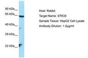 Image no. 1 for anti-Serine/threonine Kinase 35 (STK35) (AA 106-155) antibody (ABIN6750141) (STK35 抗体  (AA 106-155))
