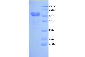 SDS-PAGE (SDS) image for Angiopoietin 2 (ANGPT2) (AA 19-485), (partial) protein (His tag) (ABIN5713224)