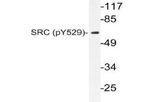 Western blot (WB) analysis of p-c-RAF antibody in extracts from K562 cells. (NCOA1 抗体  (pTyr529))