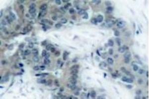 Image no. 1 for anti-Janus Kinase 2 (JAK2) (pTyr1007) antibody (ABIN318056) (JAK2 抗体  (pTyr1007))