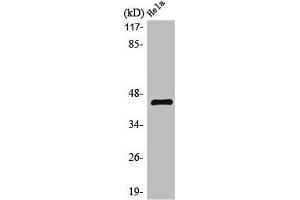 Western Blot analysis of  Hela cells using LPAAT-δ Polyclonal Antibody (AGPAT4 抗体  (Internal Region))