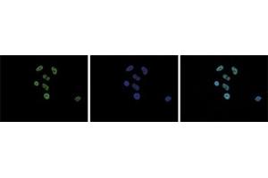 Immunofluorescent staining of Hela cell line with antibody followed by an anti-rabbit antibody conjugated to Alexa488 (left). (H2AFZ 抗体  (acLys4, acLys7, acLys11))