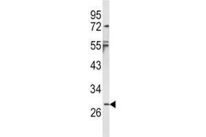Western Blotting (WB) image for anti-Interleukin 1, beta (IL1B) (AA 148-174) antibody (ABIN3031434)